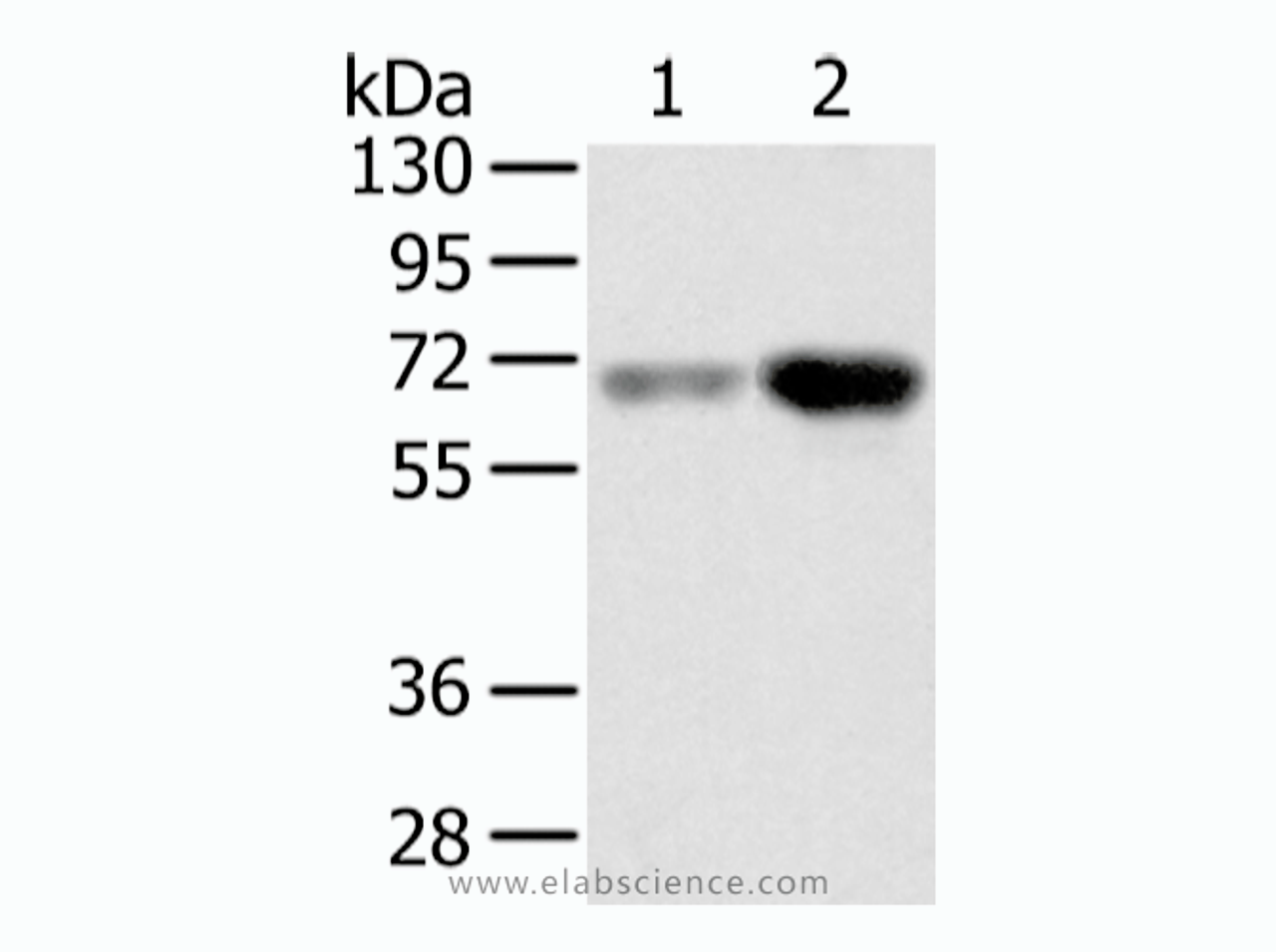 Western Blot analysis of Human lung cancer and placenta tissue using TBL1X Polyclonal Antibody at dilution of 1/500