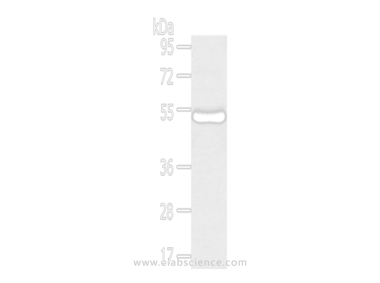 Western Blot analysis of Human thigh malignant fibrous histiocytoma tissue using TMPRSS11D Polyclonal Antibody at dilution of 1/800