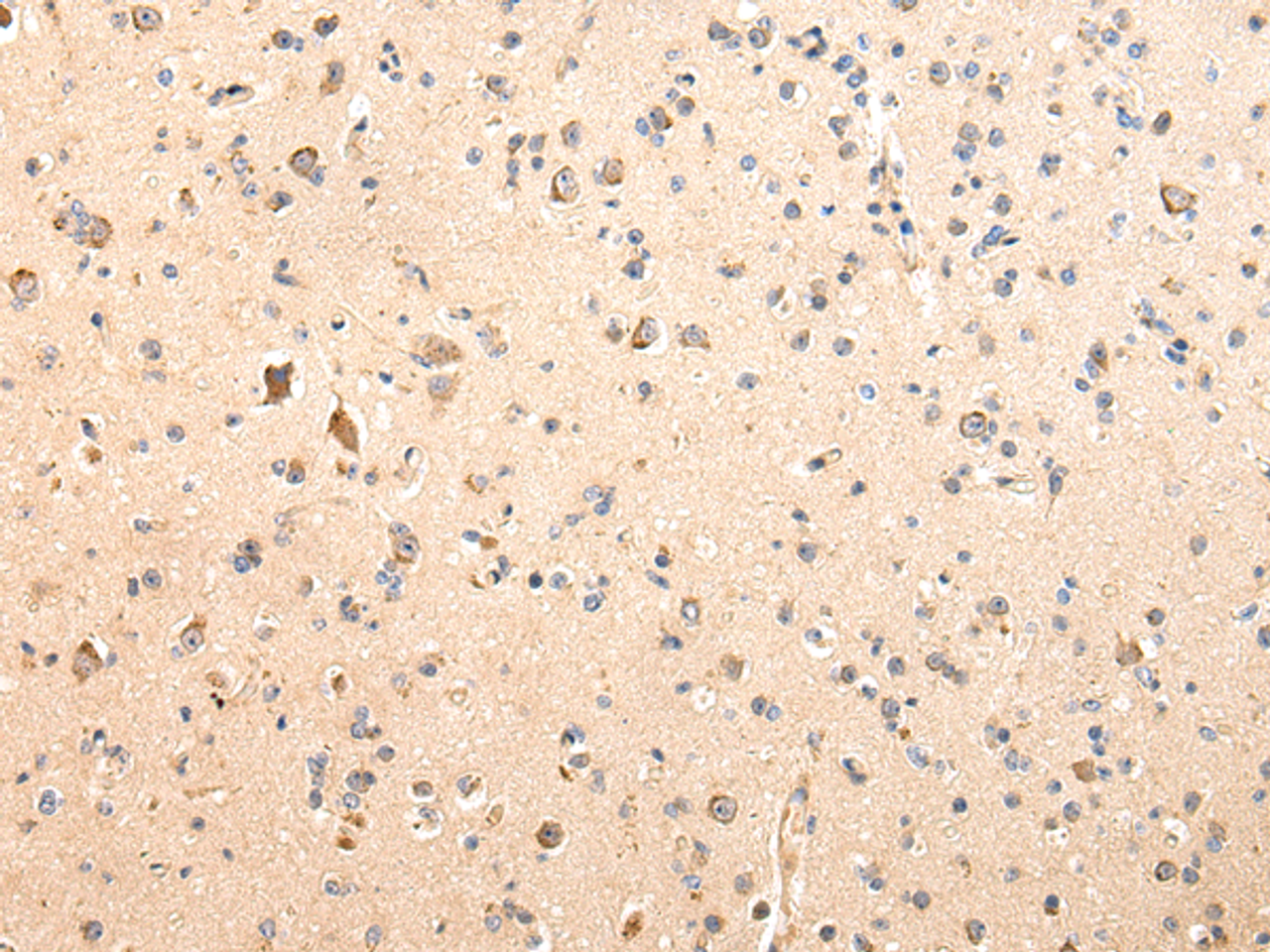 Immunohistochemistry of paraffin-embedded Human brain using SDCBP Polyclonal Antibody at dilution of  1/40