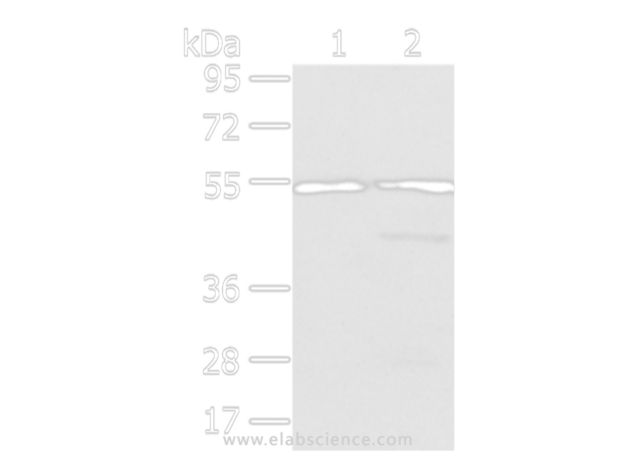 Western Blot analysis of Human normal liver and fetal liver tissue using ALDH3A2 Polyclonal Antibody at dilution of 1/250