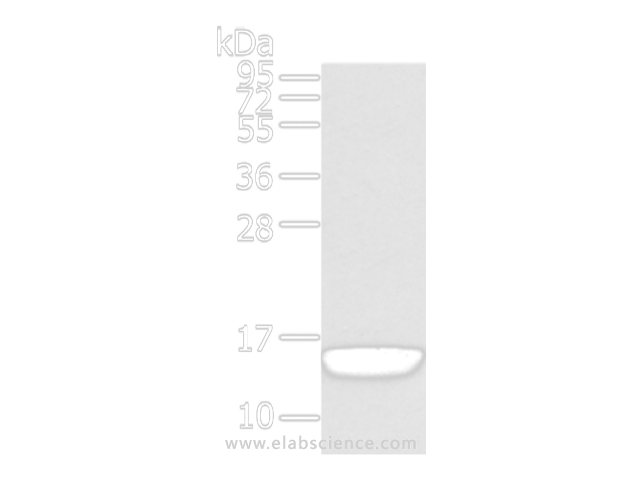 Western Blot analysis of Human normal prostate tissue using VAMP5 Polyclonal Antibody at dilution of 1/650