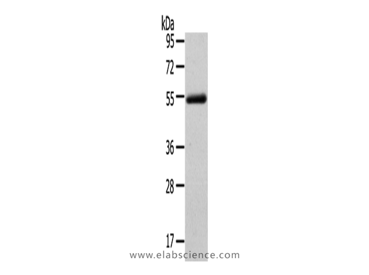 Western Blot analysis of Human normal liver tissue using FOXC1 Polyclonal Antibody at dilution of 1/400