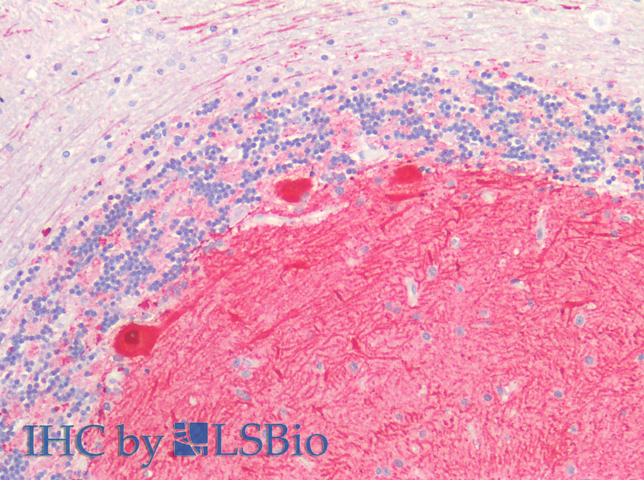 Immunohistochemistry of paraffin-embedded Human Cerebellum using GRIN2A Polyclonal Antibody at dilution of 1:50(Elabscience® Product Detected by Lifespan).