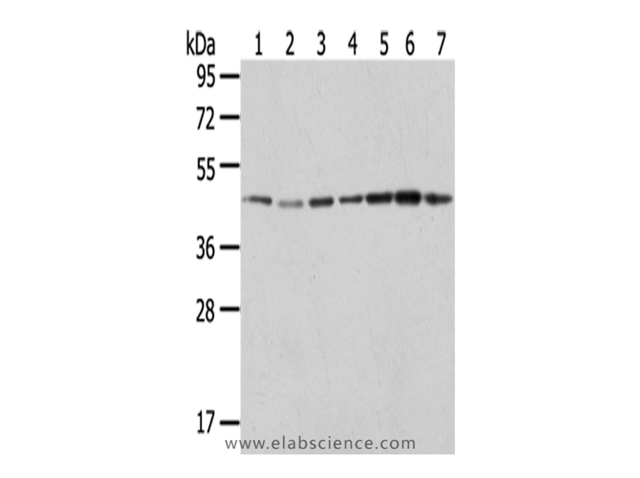 Western Blot analysis of Raji, A549, Hela, HepG2, 231, K562 and A431 cells using ERP44 Polyclonal Antibody at dilution of 1/200
