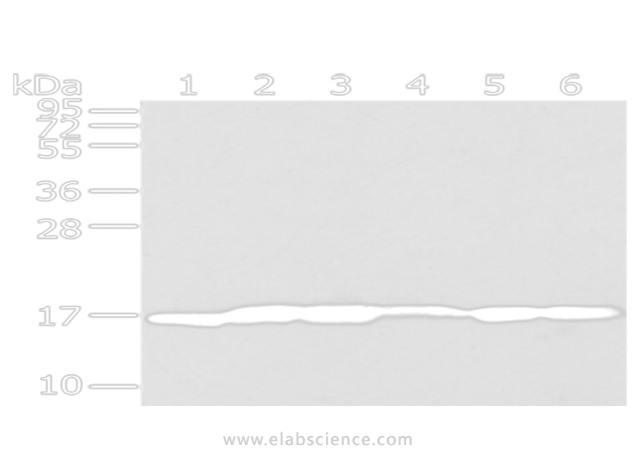 Western Blot analysis of A431 cells and Human liver cancer tissue, Lovo and PC3 cells, Human placenta tissue and 293T cells using UTS2B Polyclonal Antibody at dilution of 1/200