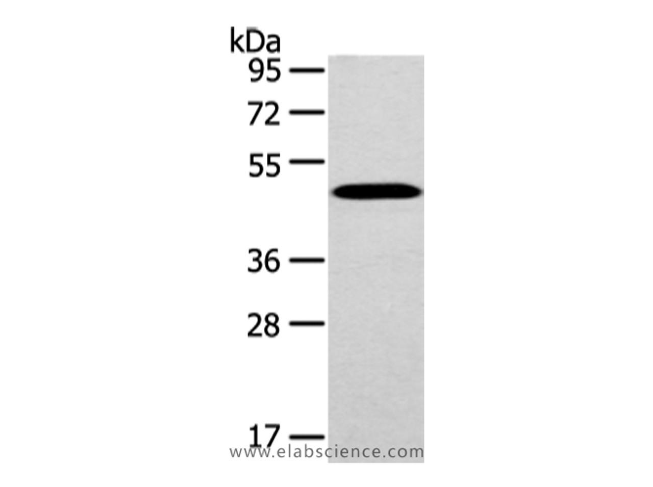 Western Blot analysis of Mouse brain tissue using WWOX Polyclonal Antibody at dilution of 1/200