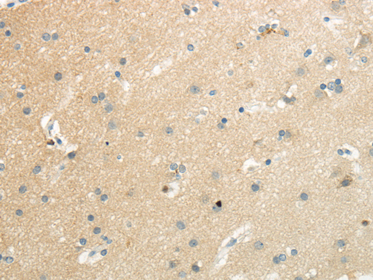 Immunohistochemistry of paraffin-embedded Human brain using SLC7A11 Polyclonal Antibody at dilution of  1/35