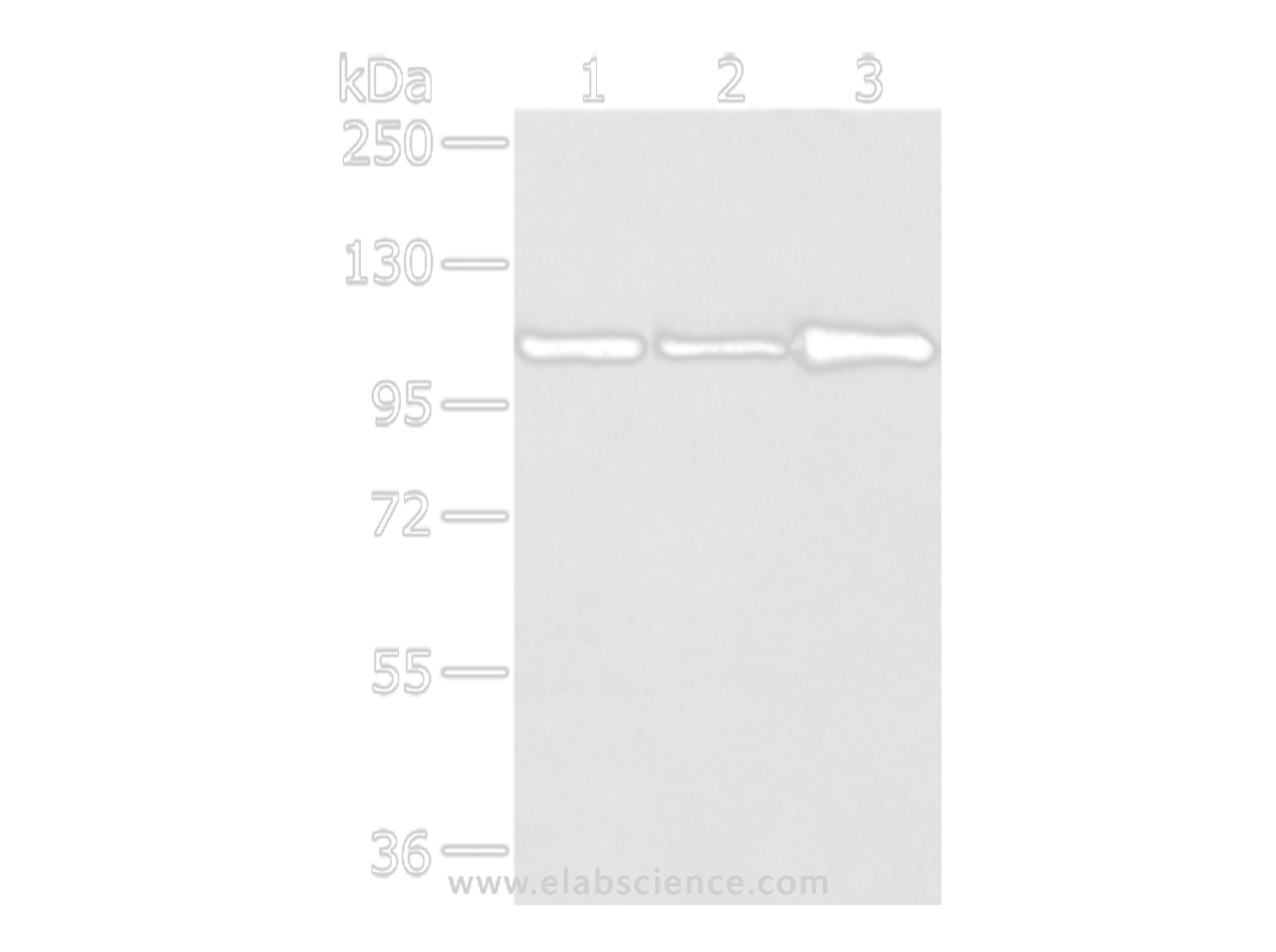 Western Blot analysis of A431, 231 and NIH/3T3 cell using AP2A1 Polyclonal Antibody at dilution of 1/250