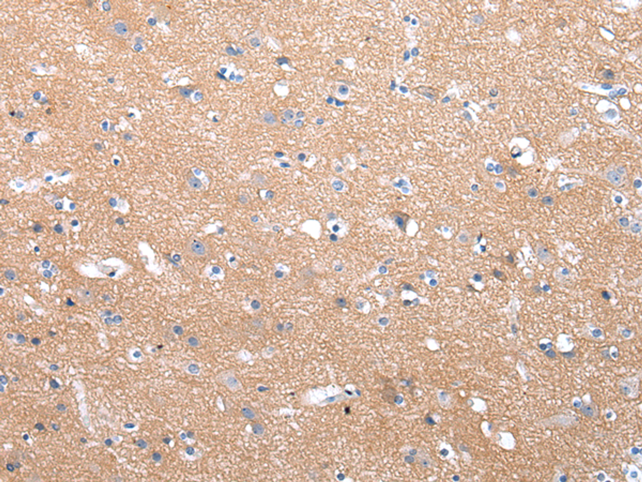 Immunohistochemistry of paraffin-embedded Human brain tissue using COLEC12 Polyclonal Antibody at dilution 1:40