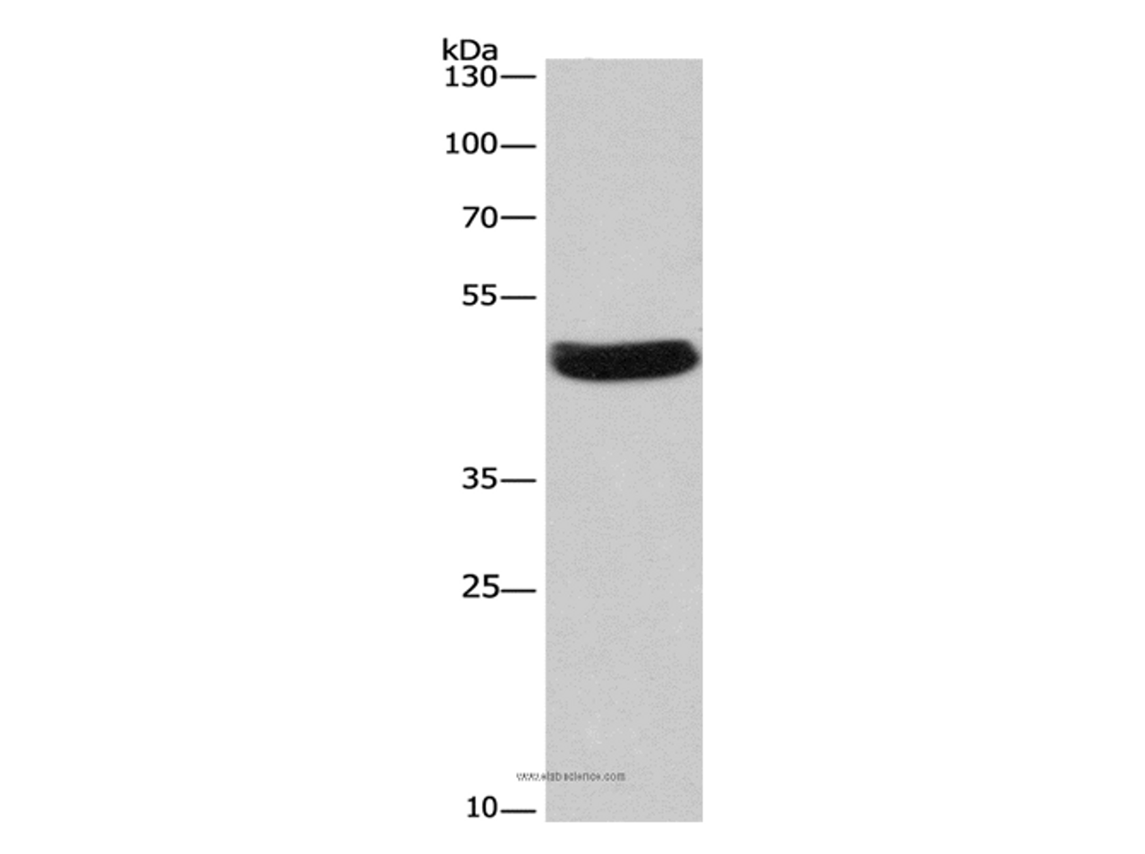 Western Blot analysis of Hela cell using SEPT7 Polyclonal Antibody at dilution of 1:380