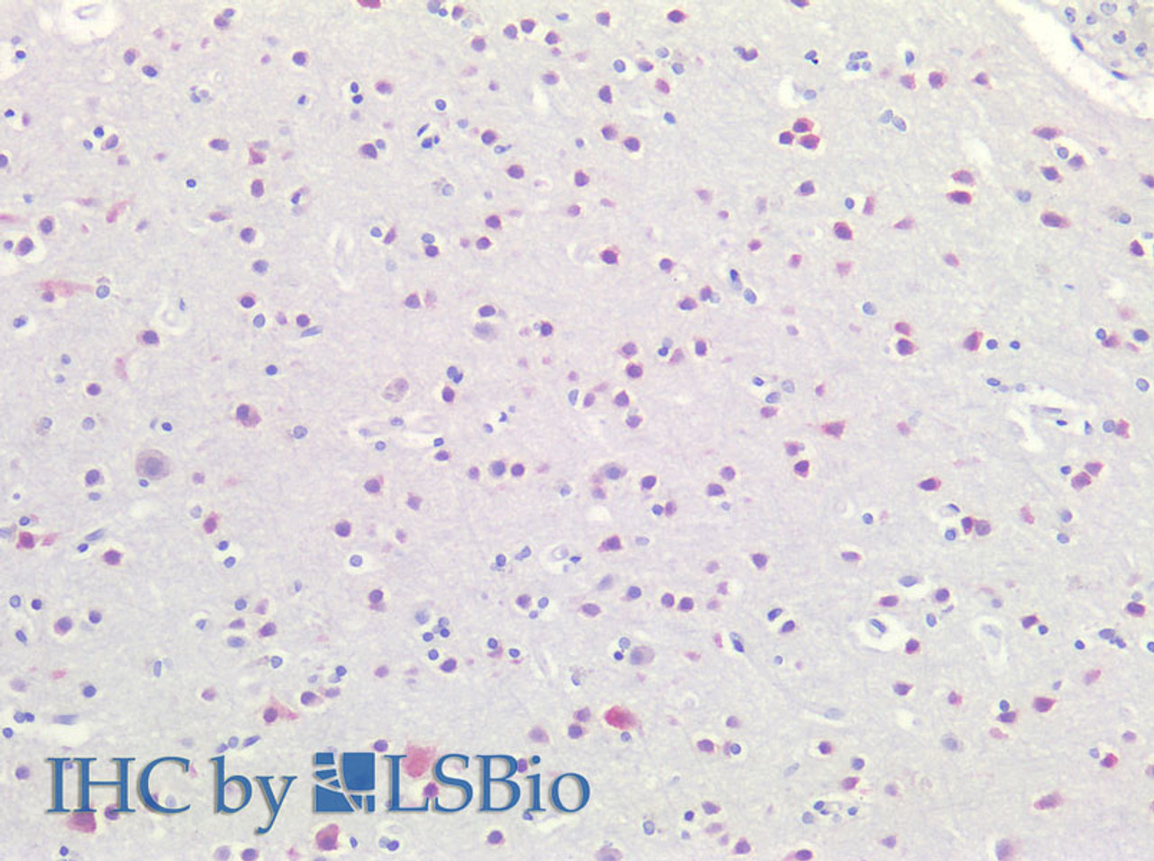 Immunohistochemistry of paraffin-embedded Human Brain using RBFOX3 Polyclonal Antibody at dilution of 1:100(Elabscience® Product Detected by Lifespan).