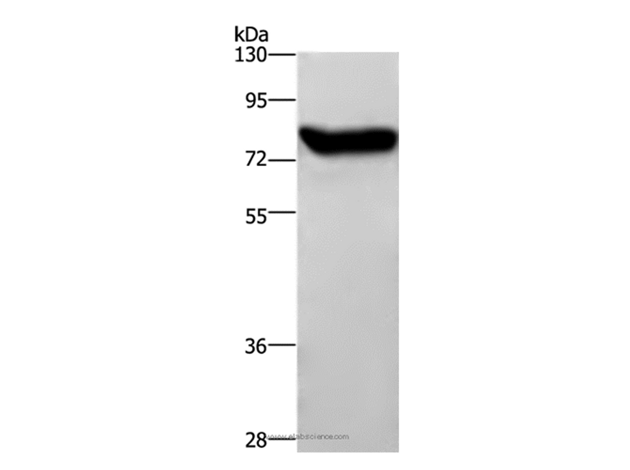 Western Blot analysis of Mouse brain tissue using Catenin beta Polyclonal Antibody at dilution of 1:450