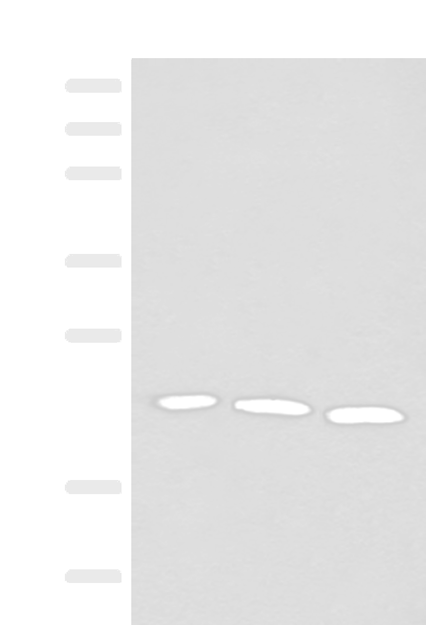 Western blot analysis of A549 HUVEC and 231 cell lysates  using FGF10 Polyclonal Antibody at dilution of 1:200