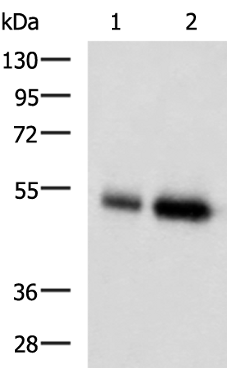 Western blot analysis of Human placenta tissue and Human right lower lung tissue lysates  using BMP5 Polyclonal Antibody at dilution of 1:450