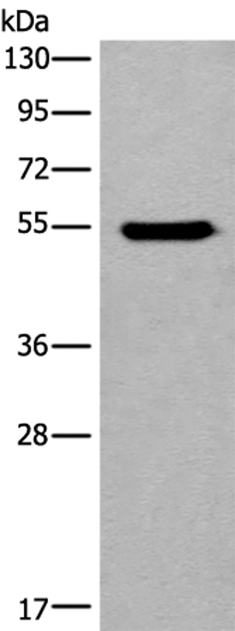 Western blot analysis of HEPG2 cell lysate  using CYP11B2 Polyclonal Antibody at dilution of 1:650