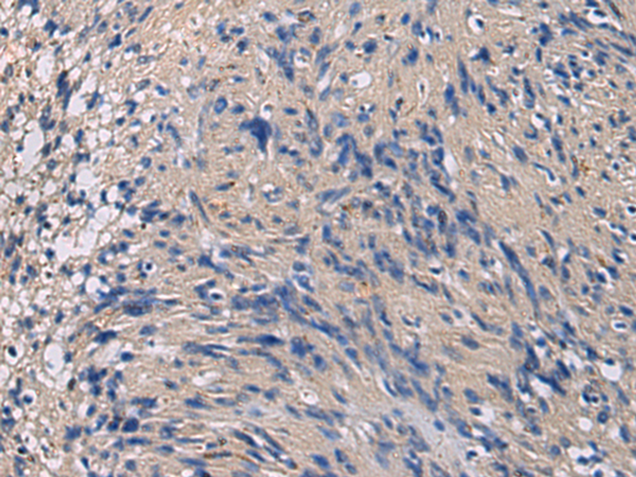 Immunohistochemistry of paraffin-embedded Human brain tissue  using CHST3 Polyclonal Antibody at dilution of 1:35(×200)