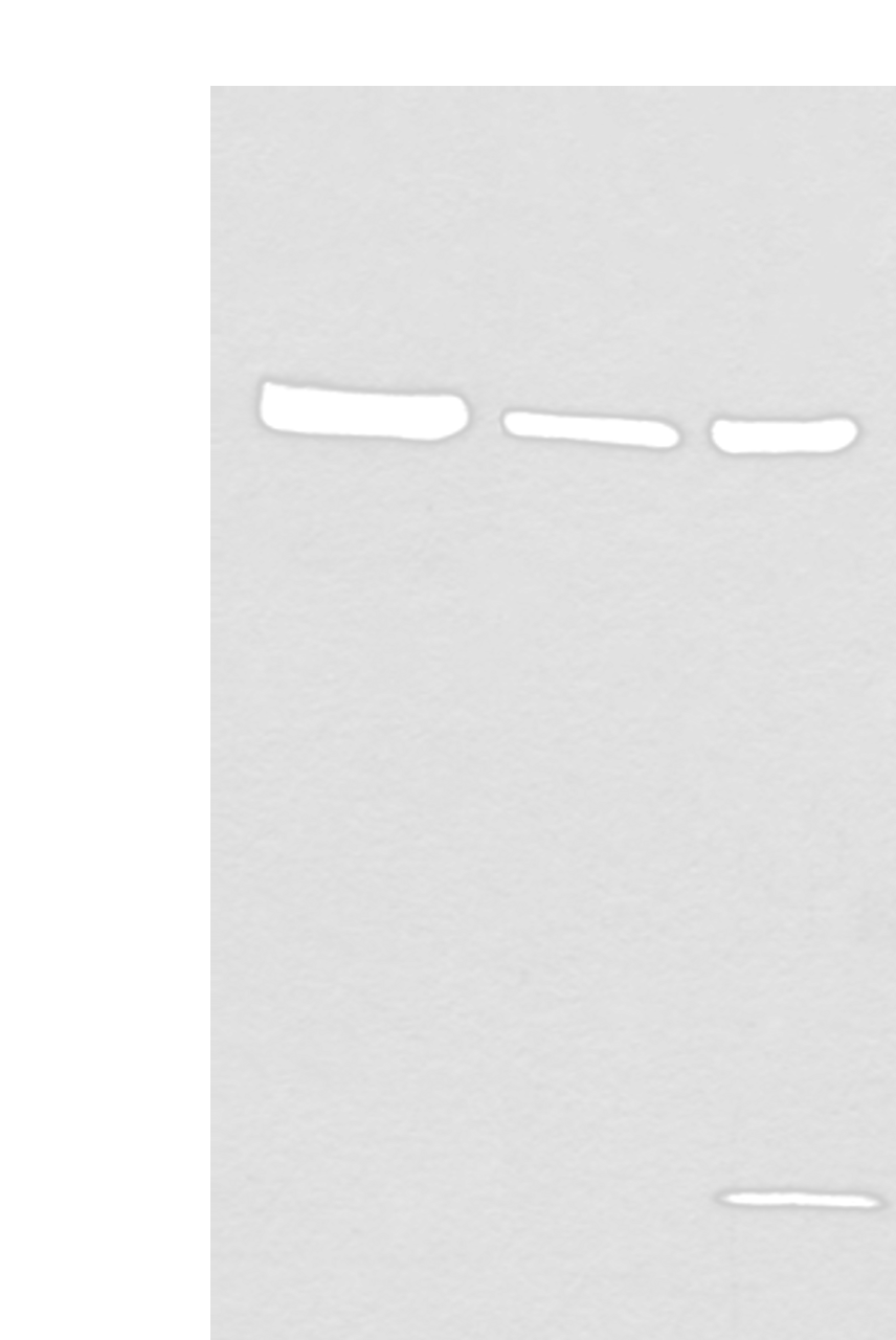 Western blot analysis of 293T cell Human testis tissue lysate A549 cell lysates  using EPHA6 Polyclonal Antibody at dilution of 1:800