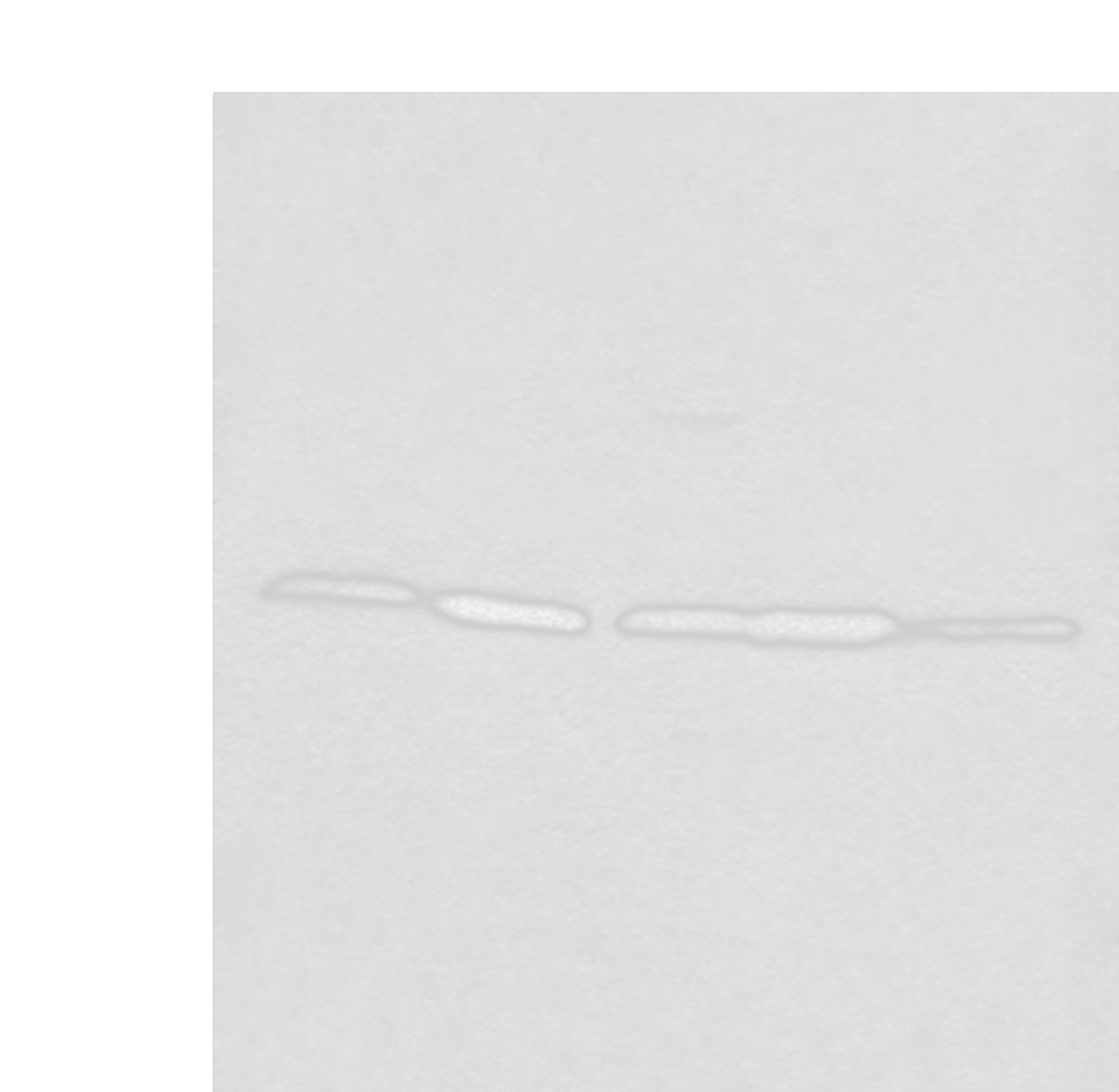 Western blot analysis of 293T Hela 231 HEPG2 and A431 cell lysates  using RPL14 Polyclonal Antibody at dilution of 1:800