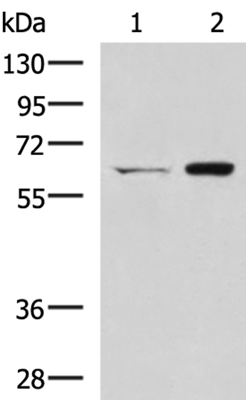 Western blot analysis of HT-29 and Lovo cell lysates  using CGAS Polyclonal Antibody at dilution of 1:400