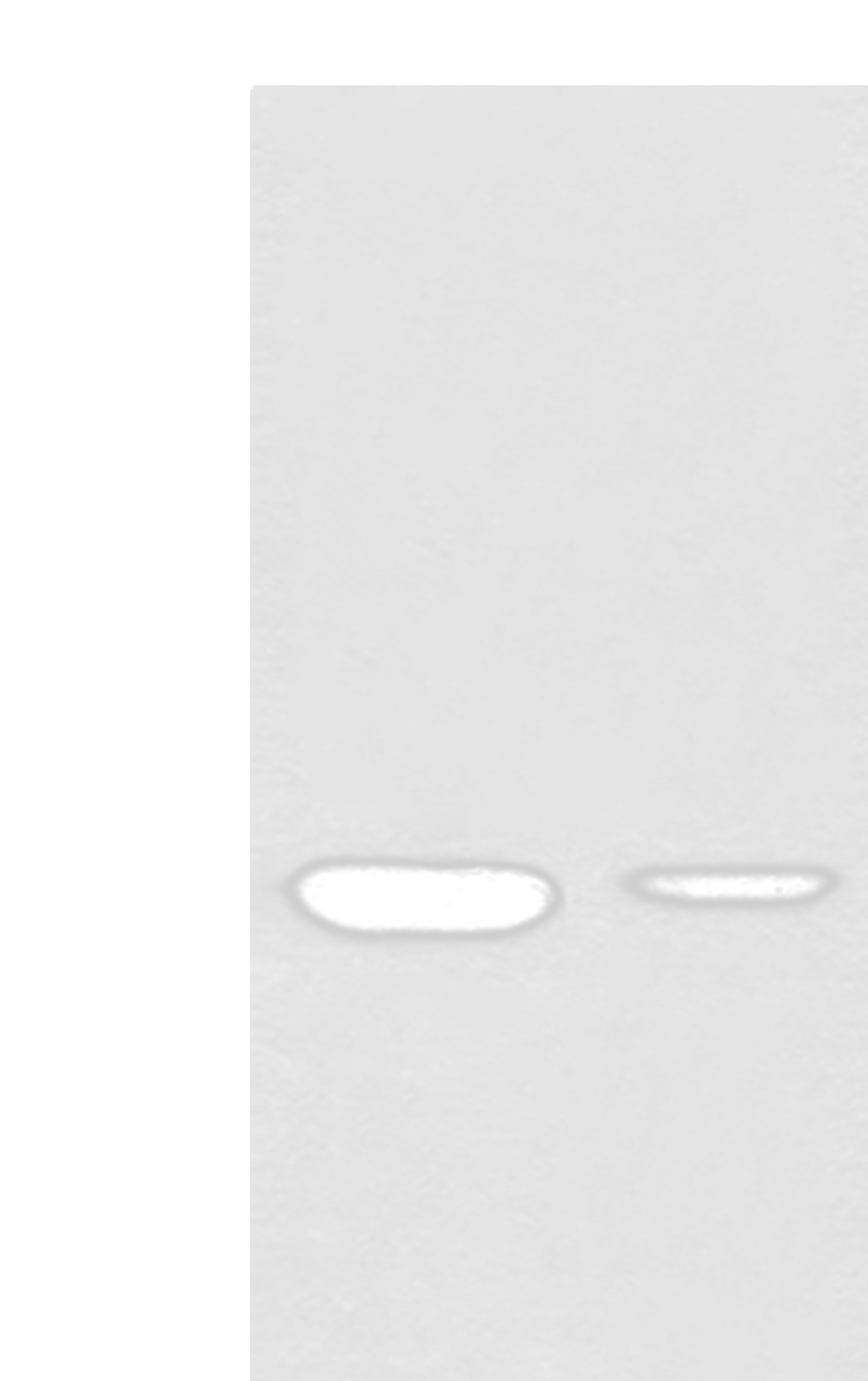 Western blot analysis of Mouse liver tissue and Human fetal liver tissue lysates  using RGN Polyclonal Antibody at dilution of 1:500