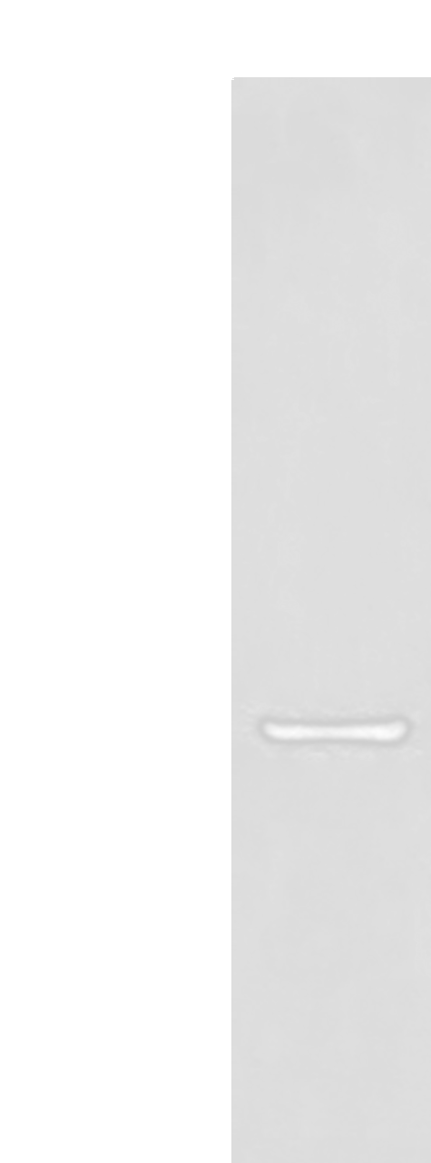 Western blot analysis of Human fetal liver tissue lysate  using DMGDH Polyclonal Antibody at dilution of 1:800