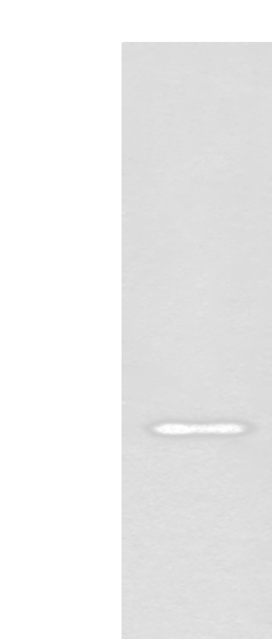 Western blot analysis of Jurkat cell lysate  using EN2 Polyclonal Antibody at dilution of 1:400