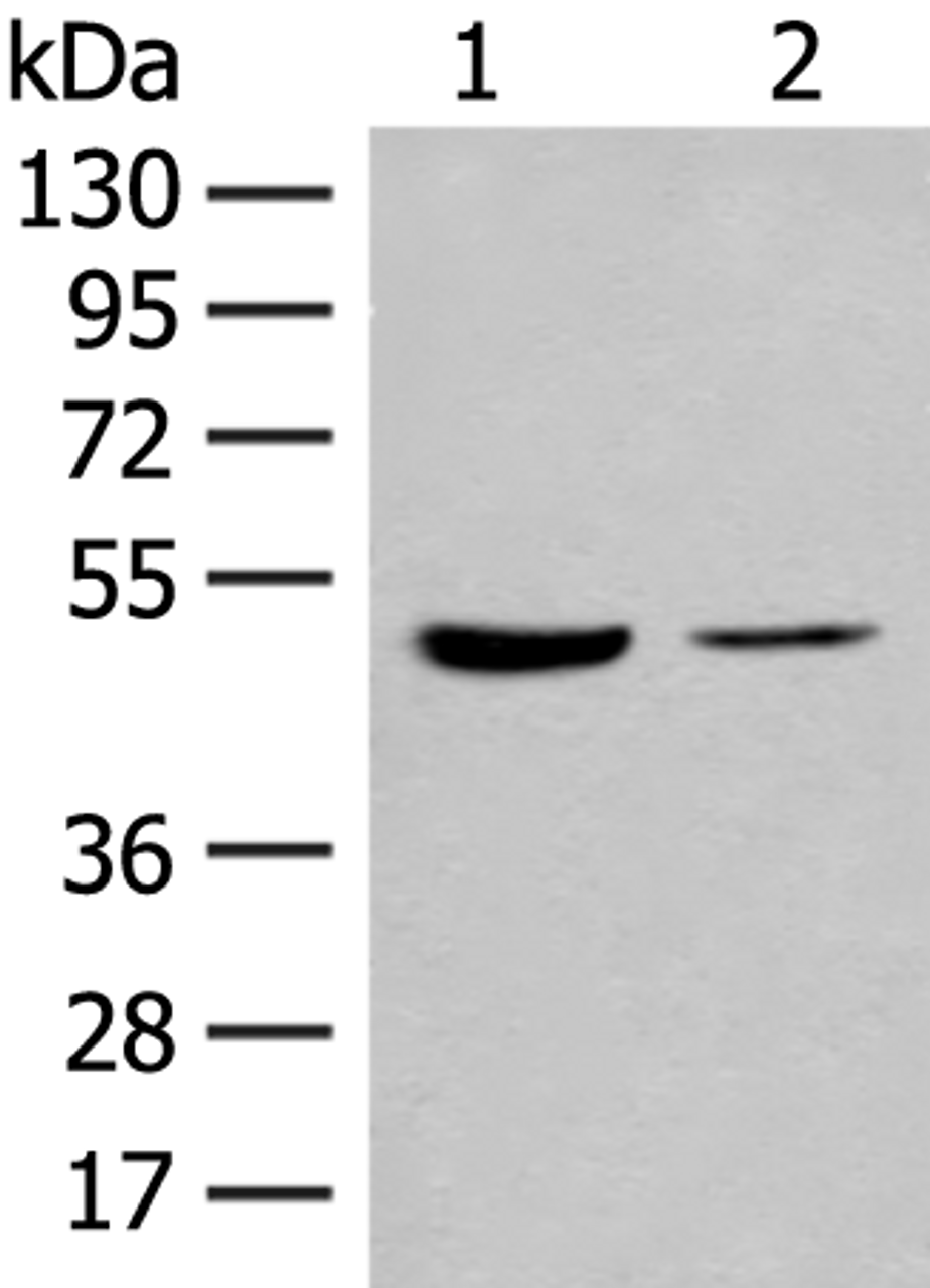 Western blot analysis of Human fetal brain tissue and Jurkat cell lysates  using IL7R Polyclonal Antibody at dilution of 1:500