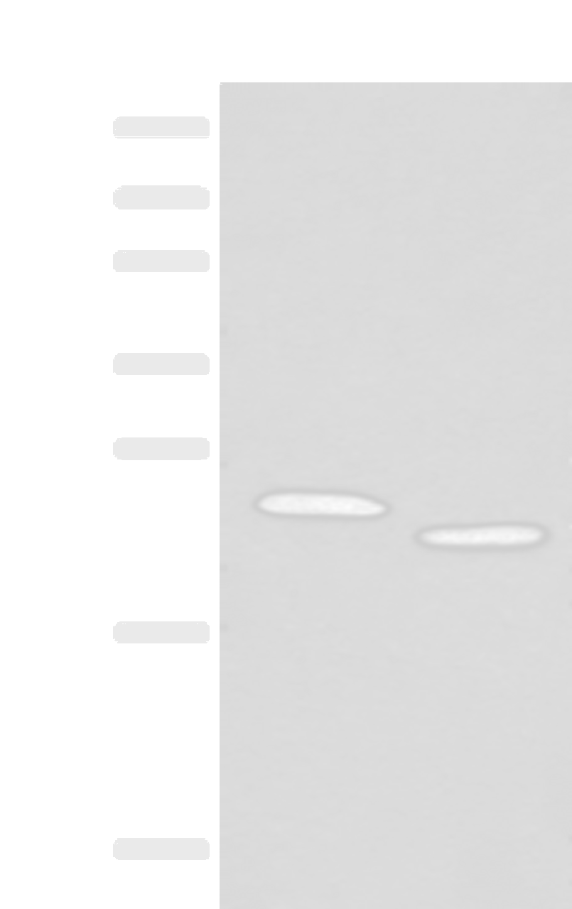 Western blot analysis of Human fat tissue and A375 cell lysates  using FAM213A Polyclonal Antibody at dilution of 1:400