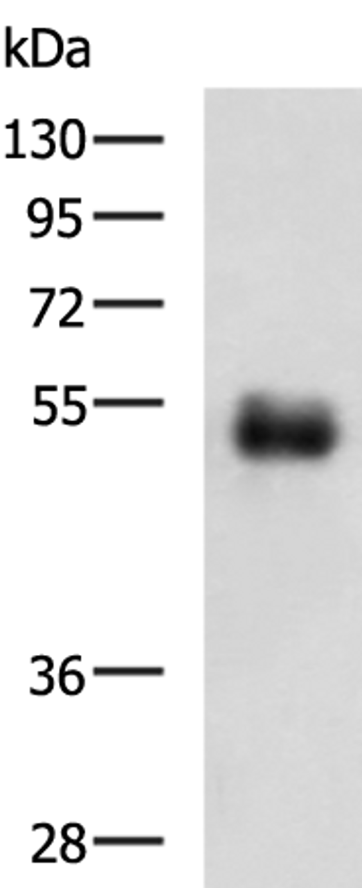 Western blot analysis of Human colorectal cancer tissue lysate  using METTL17 Polyclonal Antibody at dilution of 1:700
