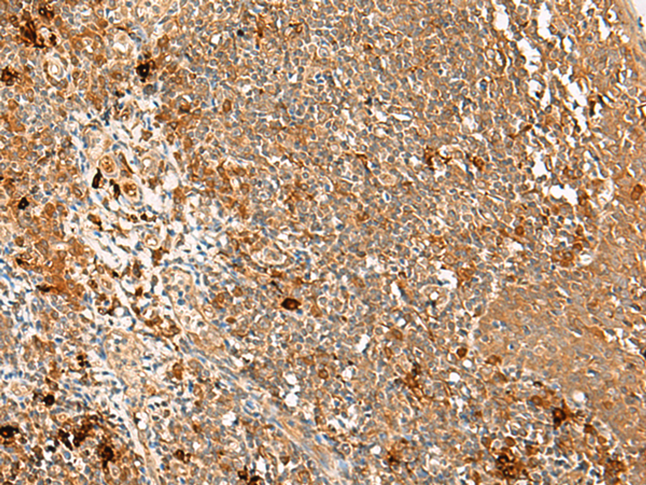 Immunohistochemistry of paraffin-embedded Human tonsil tissue  using METTL17 Polyclonal Antibody at dilution of 1:60(×200)