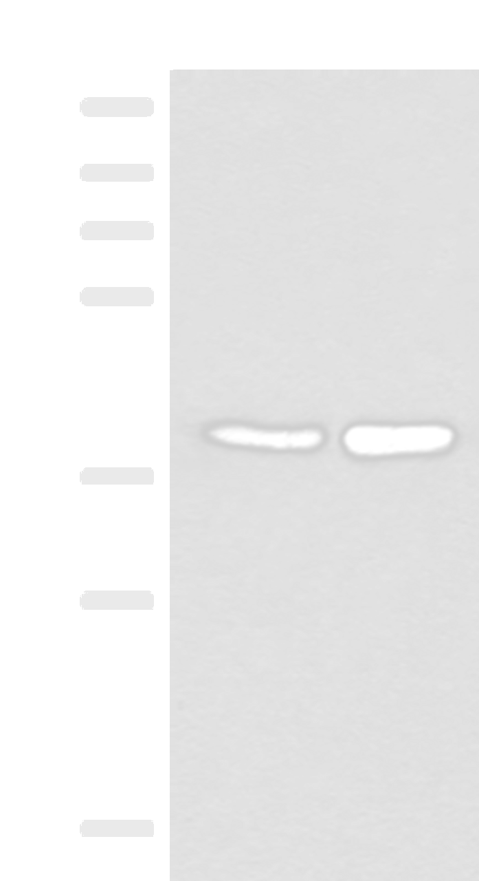 Western blot analysis of HUVEC and PC3 cell lysates  using FAM84B Polyclonal Antibody at dilution of 1:400