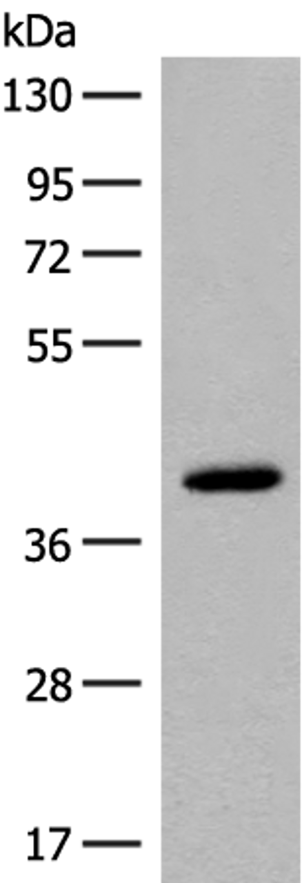 Western blot analysis of Human placenta tissue lysate  using FCGRT Polyclonal Antibody at dilution of 1:400