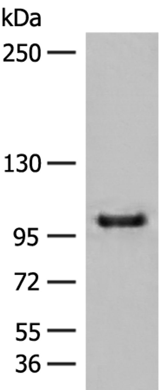 Western blot analysis of HEPG2 cell lysate  using CTDP1 Polyclonal Antibody at dilution of 1:500