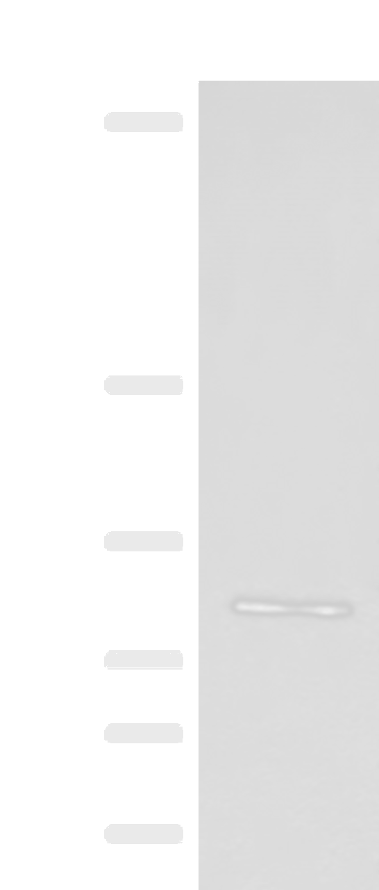 Western blot analysis of Jurkat cell lysate  using FGD3 Polyclonal Antibody at dilution of 1:500