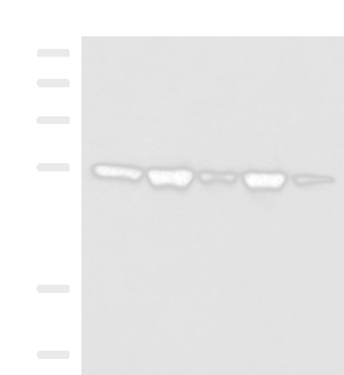 Western blot analysis of A172 Hela HepG2 K562 and PC3 cell lysates  using FKBP5 Polyclonal Antibody at dilution of 1:600