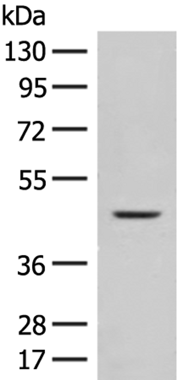 Western blot analysis of Mouse liver tissue lysate  using FUT10 Polyclonal Antibody at dilution of 1:450