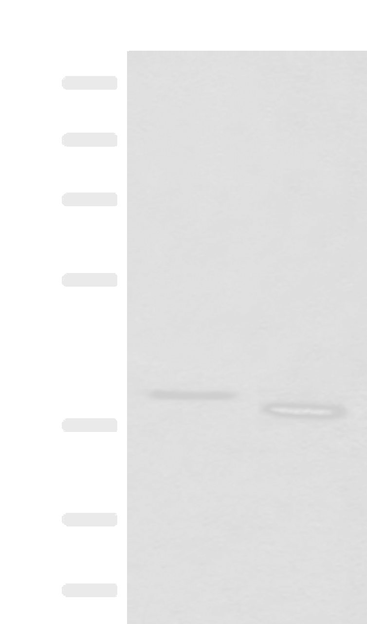 Western blot analysis of 293T cell lysates  using GALR1 Polyclonal Antibody at dilution of 1:500