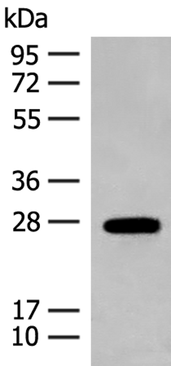 Western blot analysis of Mouse eye tissue lysate  using GUCA1B Polyclonal Antibody at dilution of 1:500