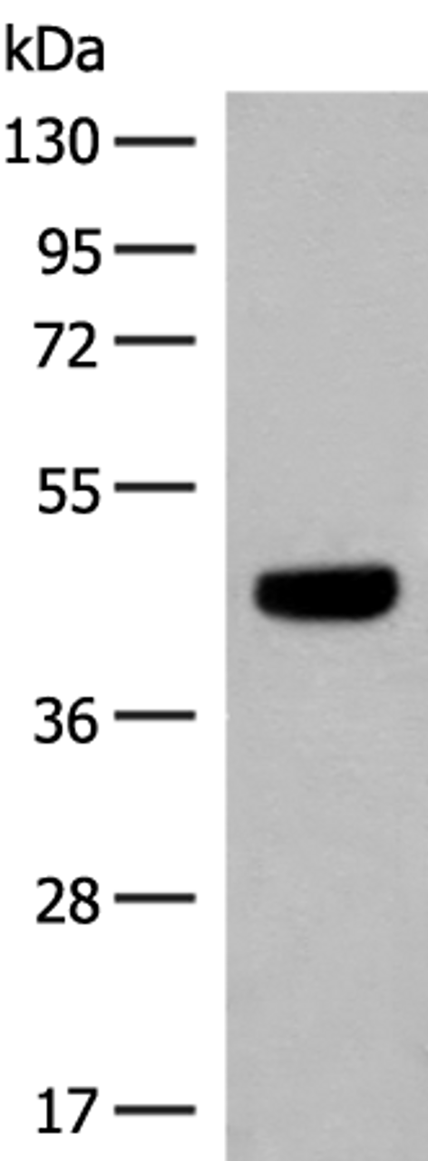 Western blot analysis of HT29 cell lysate  using GNAT1 Polyclonal Antibody at dilution of 1:250