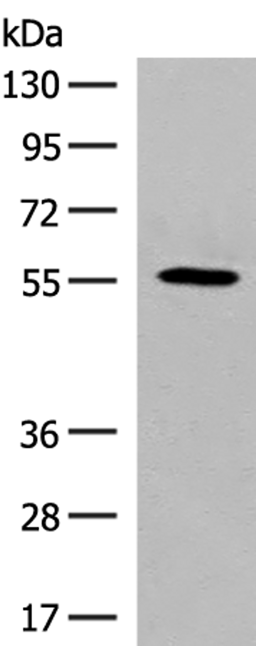 Western blot analysis of HepG2 cell lysate  using GPR22 Polyclonal Antibody at dilution of 1:500