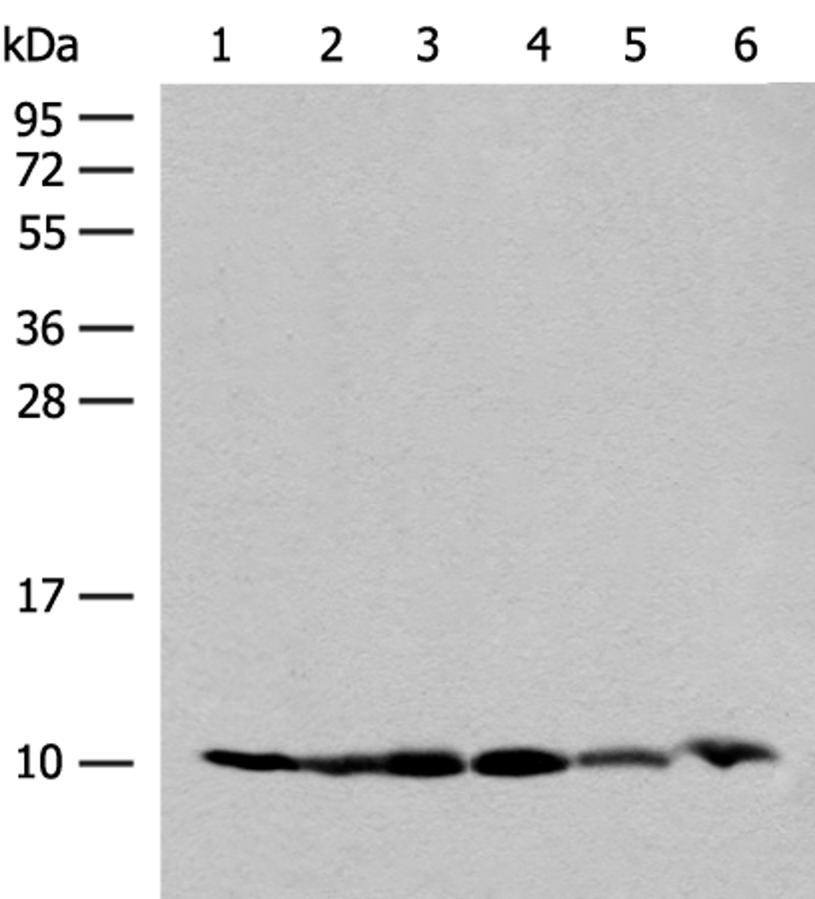 Western blot analysis of 293T and PC3 cell Mouse spleen tissue 231 cell Human breast cancer tissue Mouse kidney tissue lysates  using RPS28 Polyclonal Antibody at dilution of 1:200