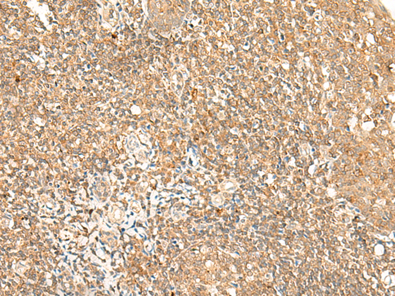 Immunohistochemistry of paraffin-embedded Human tonsil tissue  using GPR89A/GPR89B Polyclonal Antibody at dilution of 1:25(×200)