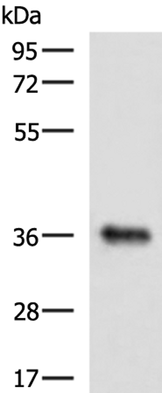 Western blot analysis of Mouse liver tissue lysate  using GRHPR Polyclonal Antibody at dilution of 1:900