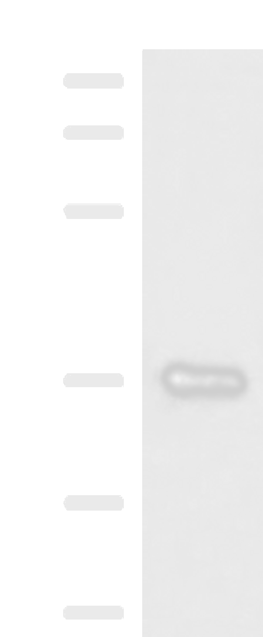 Western blot analysis of Mouse liver tissue lysate  using GRHPR Polyclonal Antibody at dilution of 1:900