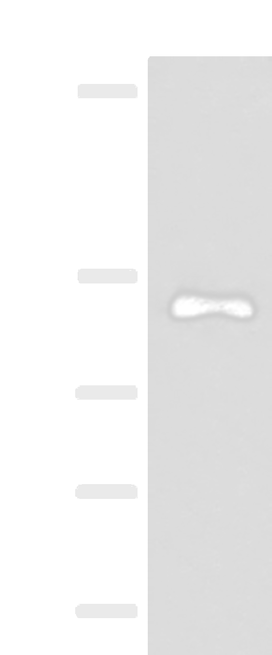 Western blot analysis of A375 cell lysate  using ARHGAP45 Polyclonal Antibody at dilution of 1:700