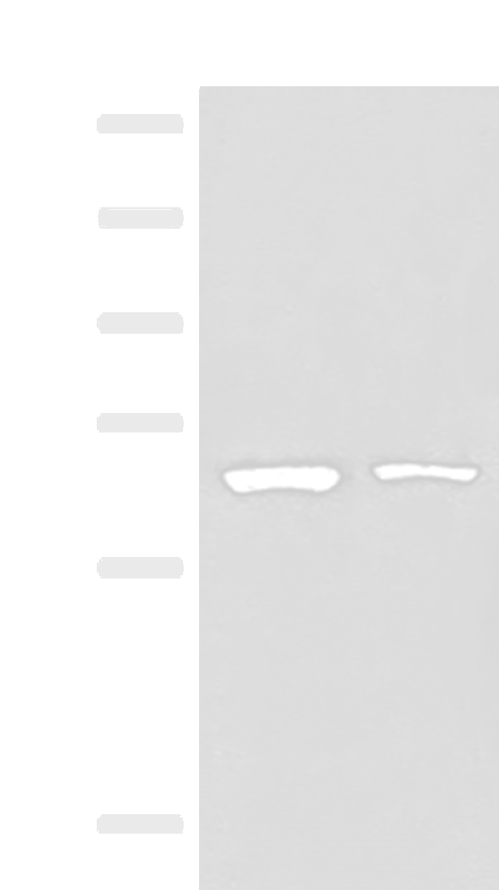 Western blot analysis of Raji and PC3 cell lysates  using ZNF85 Polyclonal Antibody at dilution of 1:400