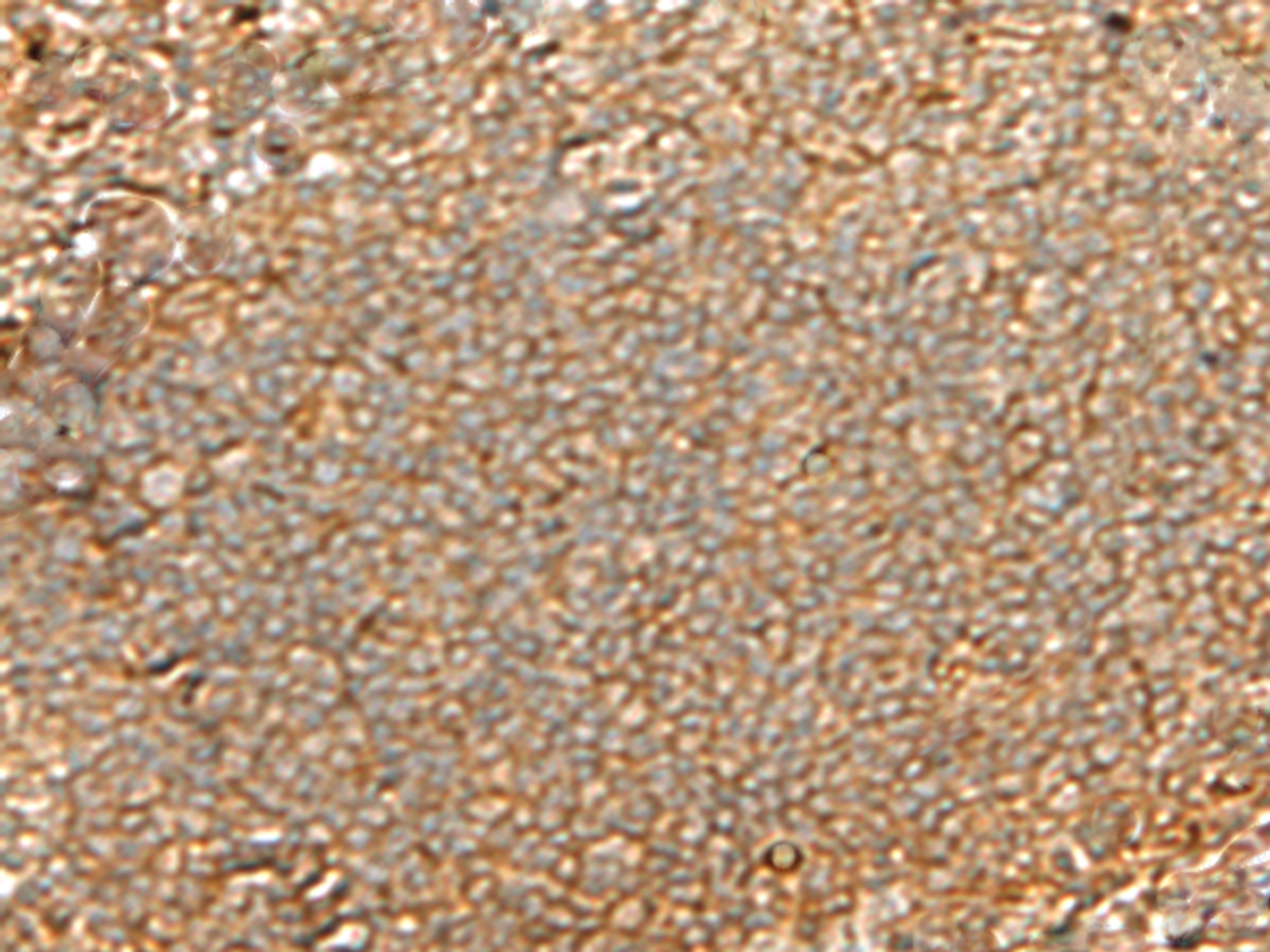 Immunohistochemistry of paraffin-embedded Human tonsil tissue  using GNGT2 Polyclonal Antibody at dilution of 1:40(×200)
