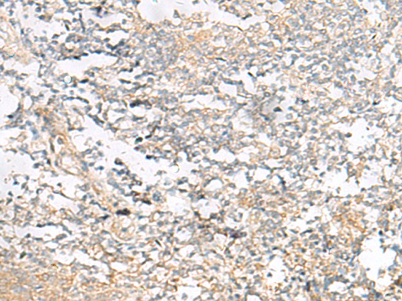 Immunohistochemistry of paraffin-embedded Human tonsil tissue  using HELT Polyclonal Antibody at dilution of 1:40(×200)