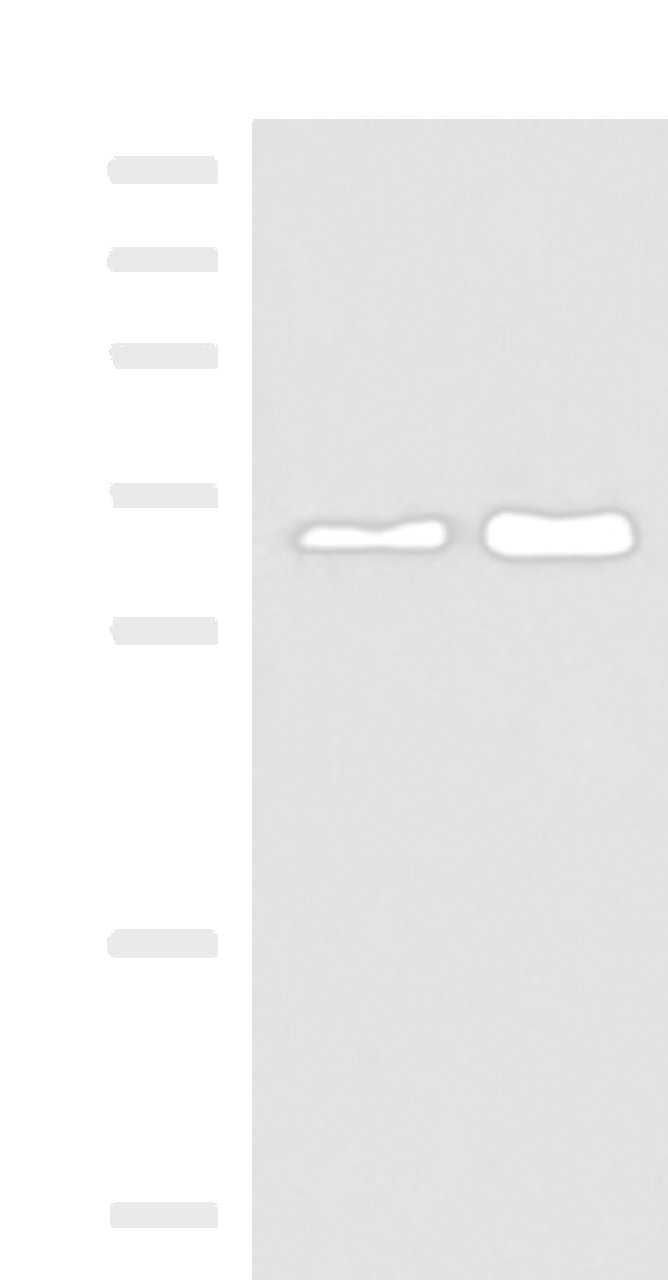 Western blot analysis of 293T cell lysates  using HNRNPA1L2 Polyclonal Antibody at dilution of 1:500