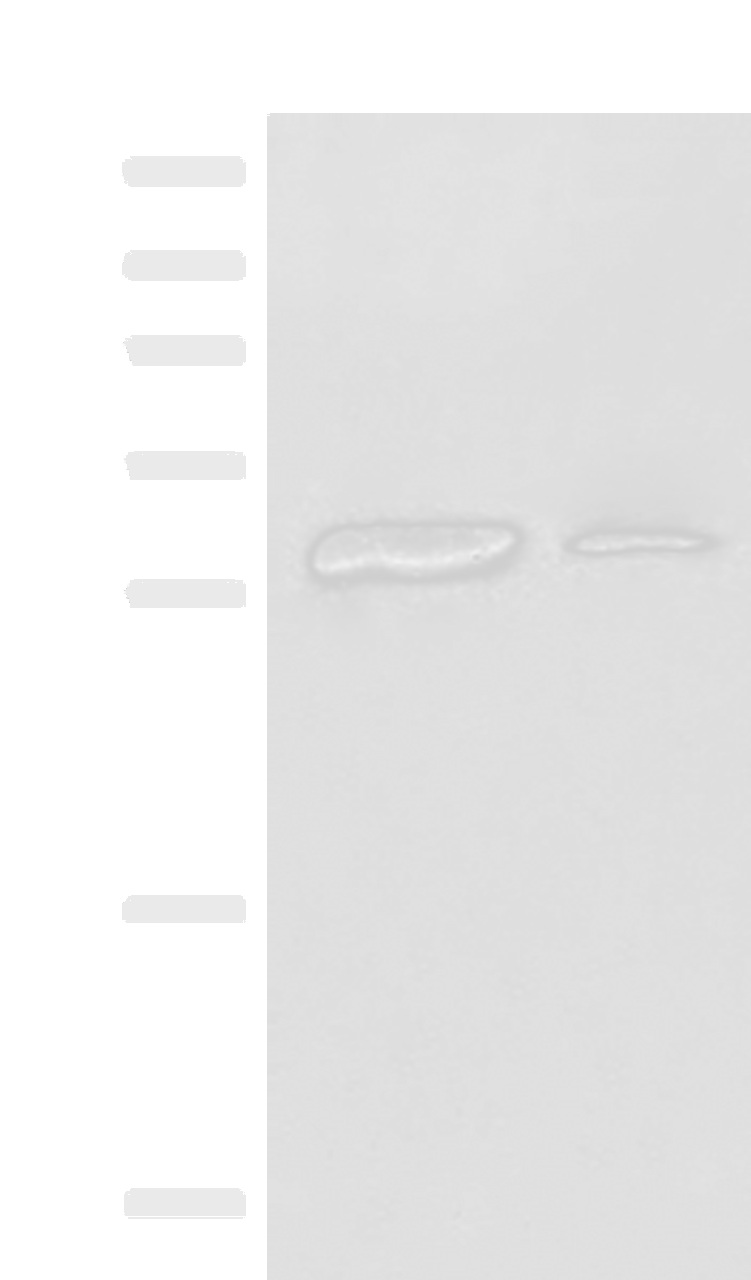 Western blot analysis of Raji cell Human spleen tissue lysates  using HLA-DPA1 Polyclonal Antibody at dilution of 1:400